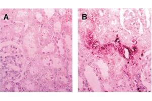 Immunohistochemistry image of CRA-modified protein staining in paraffn sections of rat kidney exposed to ferric nitrilotriacetate. (Crotonaldehyde (CRA) 抗体)