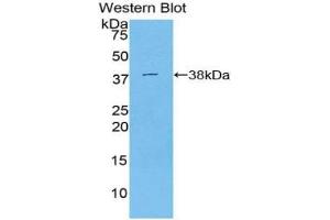 Western blot analysis of the recombinant protein. (STAP1 抗体  (AA 1-297))