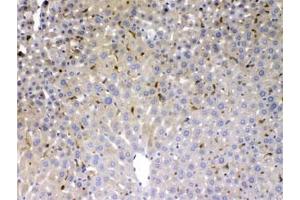 IHC testing of FFPE mouse liver with PSAT1 antibody at 1ug/ml. (PSAT1 抗体)