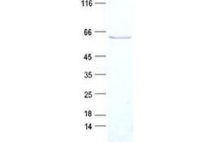 Western Blotting (WB) image for RAD52 Homolog (S. Cerevisiae) (RAD52) (Transcript Variant 3) protein (Myc-DYKDDDDK Tag) (ABIN2730415)