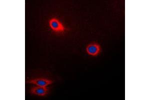 Immunofluorescent analysis of CD174 staining in Raw264. (FUT3 抗体  (Center))