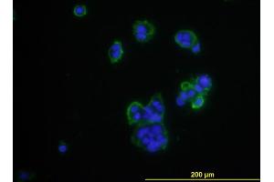 Immunofluorescence of monoclonal antibody to CD276 on MCF-7 cell . (CD276 抗体  (AA 28-238))