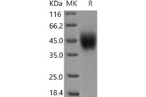 Western Blotting (WB) image for Interleukin 2 Receptor, gamma (IL2RG) protein (His tag) (ABIN7321196)