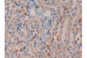 Detection of MGEA5 in Mouse Kidney Tissue using Polyclonal Antibody to Meningioma Expressed Antigen 5 (MGEA5) (MGEA5 抗体  (AA 83-222))