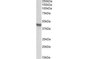 Western Blotting (WB) image for anti-Solute Carrier Family 2 (Facilitated Glucose Transporter), Member 4 (SLC2A4) (C-Term) antibody (ABIN2464873) (GLUT4 抗体  (C-Term))