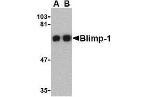 Western blot analysis of Blimp-1 in A549 cell lysate with AP30154PU-N Blimp-1 antibody at (A) 0. (PRDM1 抗体  (C-Term))