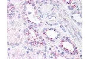 Immunohistochemistry (IHC) image for anti-Nuclear Factor-kB p65 (NFkBP65) (pSer536) antibody (ABIN129575)