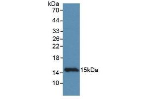 Detection of Recombinant CCDC60, Rat using Monoclonal Antibody to Coiled Coil Domain Containing Protein 60 (CCDC60) (CCDC60 抗体  (AA 127-236))