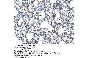 Rabbit Anti-FUSIP1 Antibody  Paraffin Embedded Tissue: Human Lung Cellular Data: Alveolar cells Antibody Concentration: 4. (SRSF10 抗体  (C-Term))