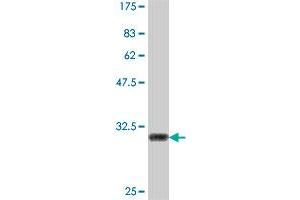 Western Blotting (WB) image for anti-Potassium Inwardly-Rectifying Channel, Subfamily J, Member 5 (KCNJ5) (AA 136-204) antibody (ABIN564116)