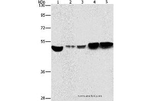 Western blot analysis of Hela and A431 cell, mouse brain and liver tissue, mouse pancreas tissue, using ENO1 Polyclonal Antibody at dilution of 1:500 (ENO1 抗体)