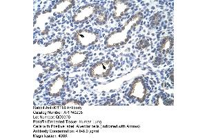 Rabbit Anti-KRT18 Antibody  Paraffin Embedded Tissue: Human Lung Cellular Data: Alveolar cells Antibody Concentration: 4. (Cytokeratin 18 抗体  (N-Term))