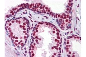 Immunohistochemistry (IHC) image for anti-Runt-Related Transcription Factor 2 (RUNX2) (AA 251-351) antibody (ABIN614586) (RUNX2 抗体  (AA 251-351))