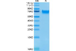 Human LILRB3 on Tris-Bis PAGE under reduced condition. (LILRB3 Protein (AA 24-443) (His-Avi Tag))