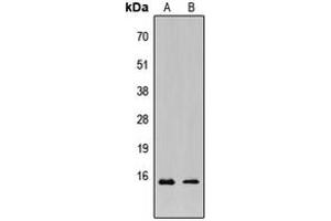 Western blot analysis of KCNE1L expression in HeLa (A), MCF7 (B) whole cell lysates. (KCNE1-Like 抗体  (Center))