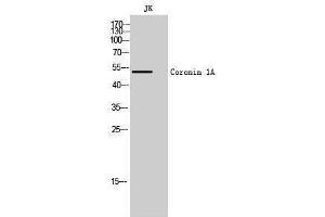 Western Blotting (WB) image for anti-Coronin, Actin Binding Protein, 1A (CORO1A) (Internal Region) antibody (ABIN3174518) (Coronin 1a 抗体  (Internal Region))