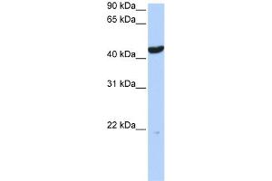 WB Suggested Anti-KRT23 Antibody Titration:  0. (KRT23 抗体  (Middle Region))