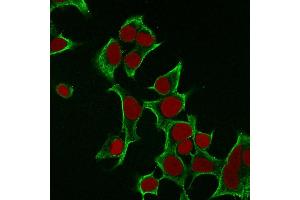 Immunofluorescence Analysis of MCF cells labeling Cytokeratin 8 with KRT8 Mouse Monoclonal Antibody (B22.
