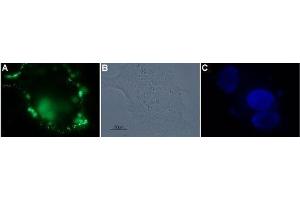 Expression of PAR-4 in a human breast adenocarcinoma cell line - Cell surface detection of PAR-4 in a human breast adenocarcinoma cell line.