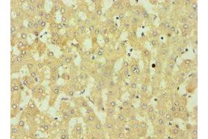 Immunohistochemistry of paraffin-embedded human liver tissue using ABIN7149891 at dilution of 1:100 (DKK4 抗体  (AA 19-224))