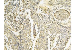 IHC analysis of CPAMD8 using anti-CPAMD8 antibody (ABIN6719649). (CPAMD8 抗体  (AA 58-234))