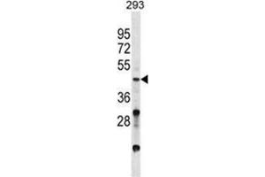 VSX2 Antibody (C-term) western blot analysis in 293 cell line lysates (35 µg/lane). (VSX2 抗体  (C-Term))