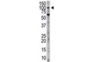 Western Blotting (WB) image for anti-Hexokinase 3 (White Cell) (HK3) antibody (ABIN3003707) (HK3 抗体)