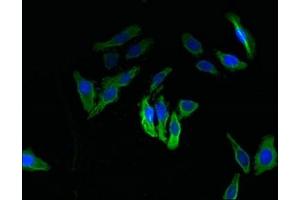 Immunofluorescent analysis of HepG2 cells using ABIN7171996 at dilution of 1:100 and Alexa Fluor 488-congugated AffiniPure Goat Anti-Rabbit IgG(H+L) (TXNDC11 抗体  (AA 656-985))