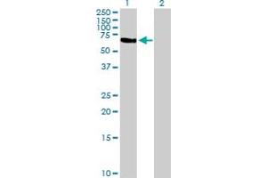 Western Blot analysis of TFCP2 expression in transfected 293T cell line by TFCP2 MaxPab polyclonal antibody. (TFCP2 抗体  (AA 1-502))