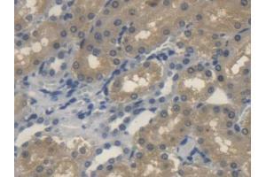 Immunohistochemistry (IHC) image for anti-Sonic Hedgehog (SHH) (AA 237-399) antibody (ABIN5013678)