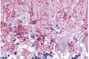Human Brain, Cerebellum: Formalin-Fixed, Paraffin-Embedded (FFPE) (KPNA3 抗体  (C-Term))