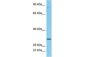 Host:  Rabbit  Target Name:  CBR3  Sample Type:  COLO205 Whole Cell lysates  Antibody Dilution:  1. (CBR3 抗体  (Middle Region))