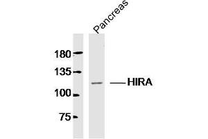 Mouse pancreas lysates probed with HIRA Polyclonal Antibody, Unconjugated  at 1:300 dilution and 4˚C overnight incubation. (HIRA 抗体  (AA 251-350))