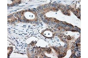 Immunohistochemical staining of paraffin-embedded Kidney tissue using anti-NME4 mouse monoclonal antibody. (NME4 抗体)