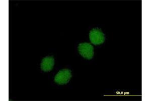 Immunofluorescence of purified MaxPab antibody to CHKB on HeLa cell. (CHKB 抗体  (AA 1-395))