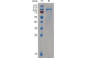 Human CD93 Protein, His Tag on SDS-PAGE under reducing condition.