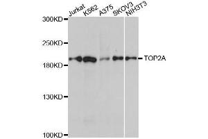 Western blot analysis of extracts of various cell lines, using TOP2A antibody.