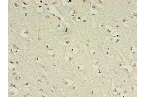 Immunohistochemistry of paraffin-embedded human brain tissue using ABIN7153483 at dilution of 1:100 (GABRA4 抗体  (AA 36-258))