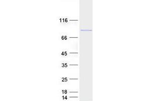 Western Blotting (WB) image for Regulatory Factor X 2 (RFX2) (Transcript Variant 1) protein (Myc-DYKDDDDK Tag) (ABIN2730793)