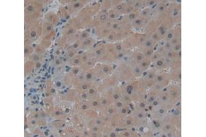 #VALUE! (Centriolin 抗体  (AA 2101-2325))