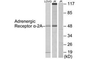 Western blot analysis of extracts from Jurkat/LOVO cells, using Adrenergic Receptor alpha-2A Antibody. (ADRA2A 抗体  (AA 331-380))