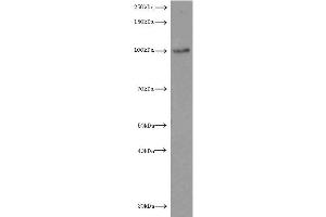 Western Blotting (WB) image for anti-Luteinizing Hormone/Choriogonadotropin Receptor (LHCGR) antibody (ABIN2937954) (LHCGR 抗体)