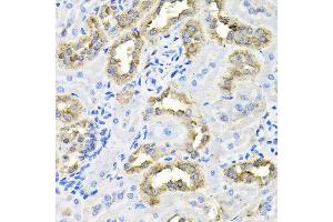 Immunohistochemistry of paraffin-embedded rat kidney using CDCA8 antibody at dilution of 1:100 (x40 lens). (CDCA8 抗体)