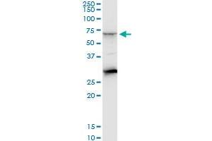 CTNS monoclonal antibody (M09), clone 5G6. (CTNS 抗体  (AA 1-100))