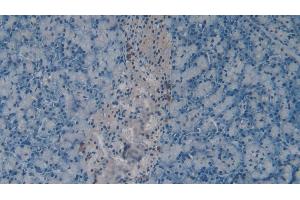 Detection of CHEM in Mouse Pancreas Tissue using Polyclonal Antibody to Chemerin (CHEM) (CHEM (AA 21-155) 抗体)