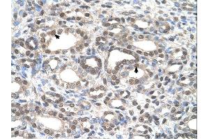 Immunohistochemistry (IHC) image for anti-Deafness, Autosomal Dominant 5 (DFNA5) (C-Term) antibody (ABIN2782489) (DFNA5 抗体  (C-Term))