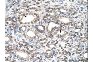 Immunohistochemistry (IHC) image for anti-Deafness, Autosomal Dominant 5 (DFNA5) (C-Term) antibody (ABIN310772) (DFNA5 抗体  (C-Term))