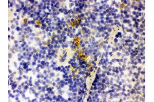 IHC analysis of Lipocalin 2 using anti-Lipocalin 2 antibody .