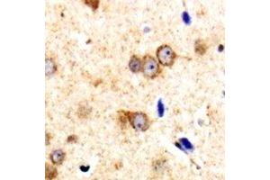 Immunohistochemical analysis of CARD11 staining in human brain formalin fixed paraffin embedded tissue section. (CARD11 抗体  (N-Term))