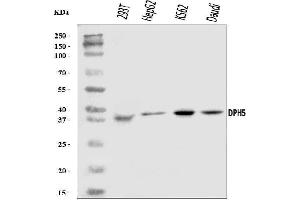 Western blot analysis of DPH5 using anti-DPH5 antibody (ABIN7599711). (DPH5 抗体  (AA 11-250))